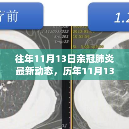 歷年11月13日新冠肺炎動態(tài)回顧，最新進展、當前動態(tài)與未來展望