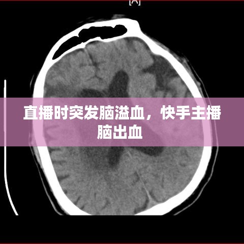 直播時(shí)突發(fā)腦溢血，快手主播腦出血 