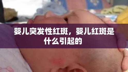 嬰兒突發(fā)性紅斑，嬰兒紅斑是什么引起的 