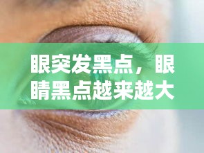 眼突發(fā)黑點(diǎn)，眼睛黑點(diǎn)越來越大 